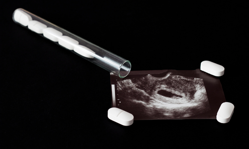 Abortion services lacking